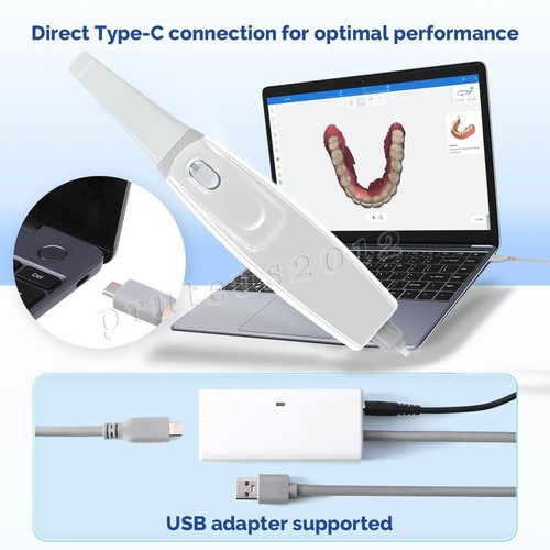 Scanner intraorale dentale - intraorale,