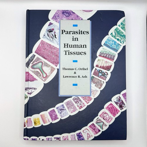 Parasites human tissues - parasites,