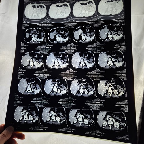 Film radiologia medica lotto - medica,
