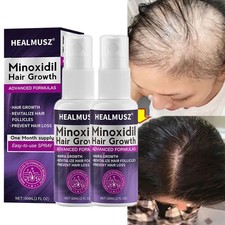 Minoxidil 2% Trattamento