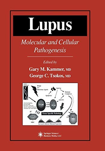 Lupus molecular and - :,