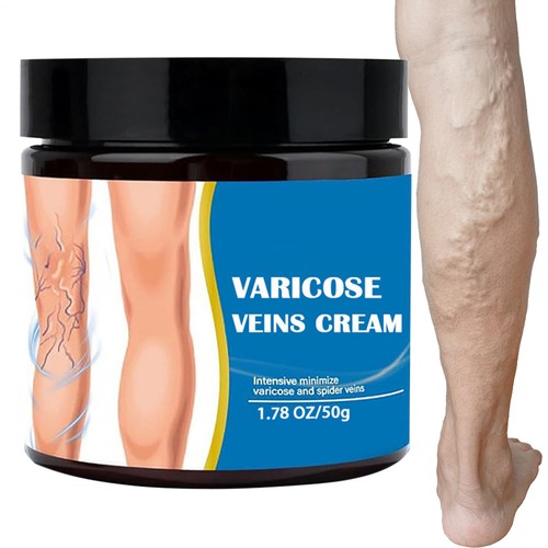 Crema sollievo vene varicose