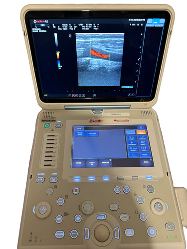 Esaote mylab alpha ultrasuoni - esaote,