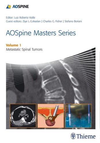 Aospine masters series - aospine, volume