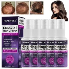 2% Minoxidil per Donna Spray