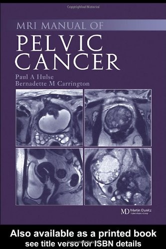 Mri manual pelvic cancer - of,