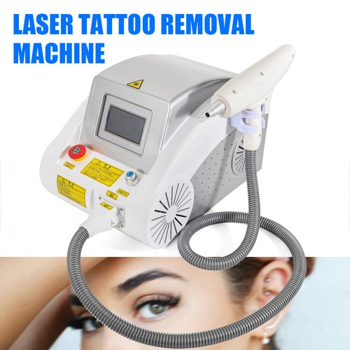 Macchina rimozione tatuaggi