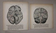 2 Stampe Anatomiche Vintage