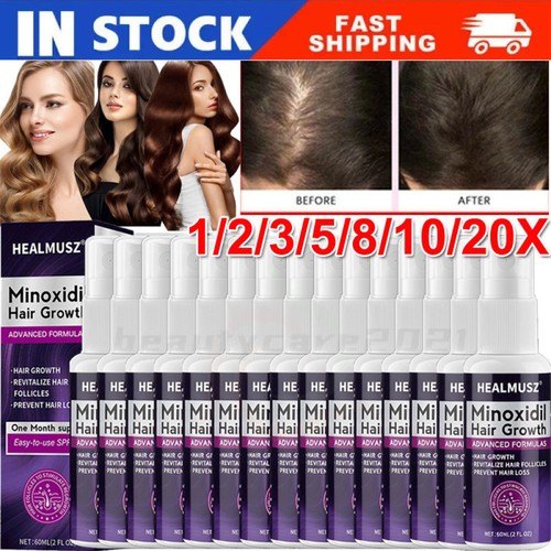5pz minoxidil extra forte - minoxidil,