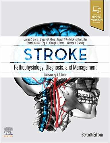 Stroke pathophysiology - stroke:,