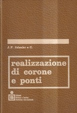 Realizzazione Di Corone E