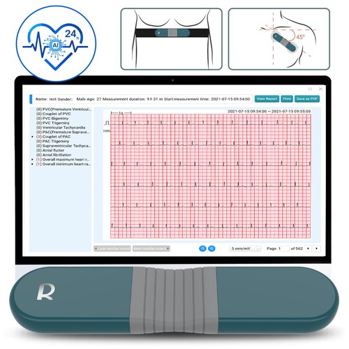 Holter monitor ecg - monitor, continuo