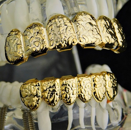 Set grillz gold nugget - set, nugget"