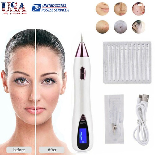 Penna laser plasma rimozione
