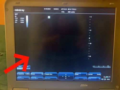 Schermo lcd per mindray m7 - schermo,