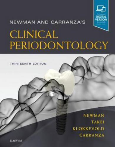 Newman and carranza - newman,