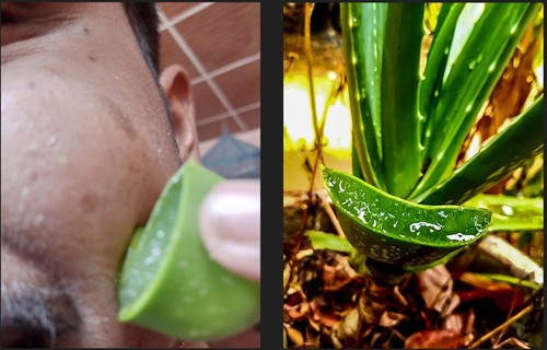 Aloe vera trattamento - , pelle