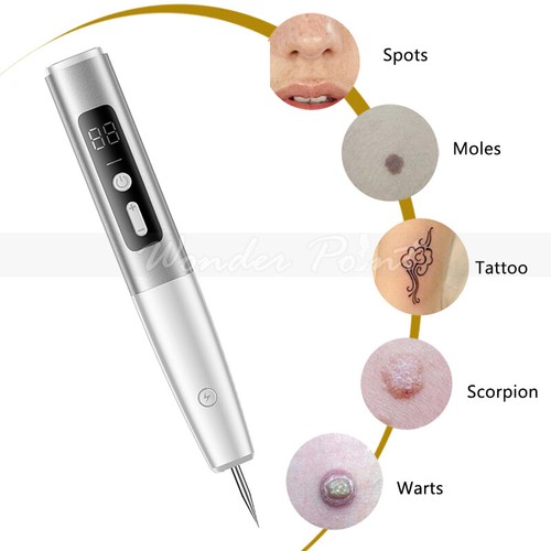 Penna laser plasma - , rimozione