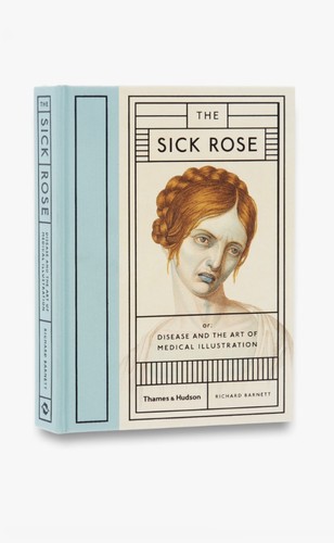 The sick rose disease and - rose:,
