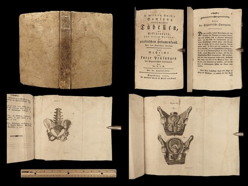 1782 obstetrics pregnancy - &,