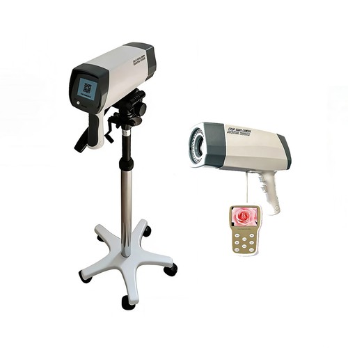 Colposcopio diagnostico