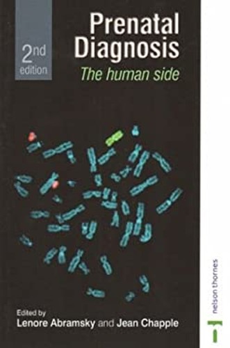 Prenatal diagnosis paperback - diagnosis,