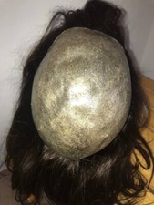 Protesi capelli donna in