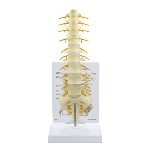 Vertebre sacre dorsale gpi - vertebre,