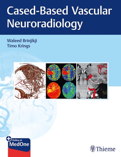 Imaging neurovascular - imaging, in
