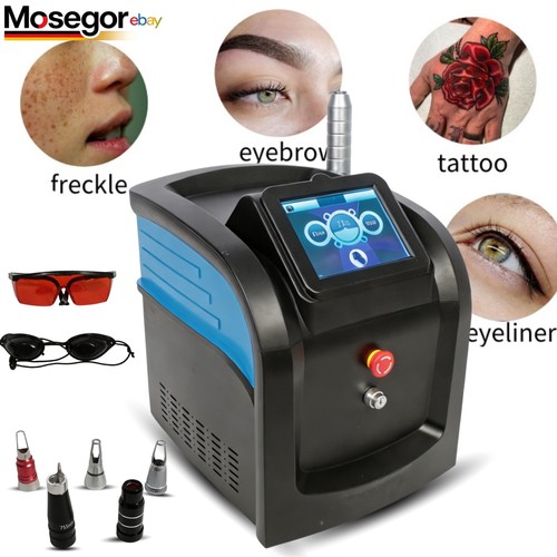 Rimozione tatuaggi acne - tatuaggi,