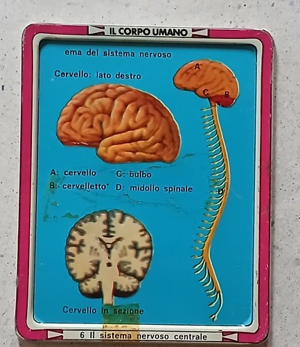 Placca metallo corpo - placca,