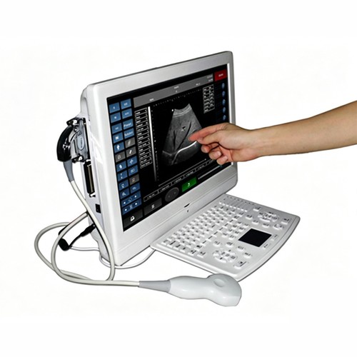 Scanner ultrasuoni lcd - ultrasuoni,