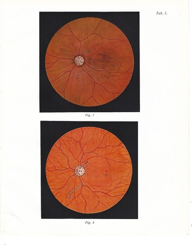 Stampa antica anatomia fondo - stampa,