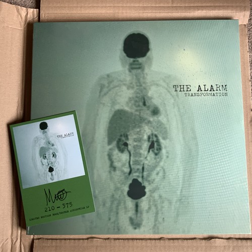 The alarm transformation - -,