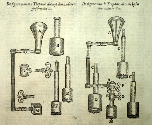 Medicina incisione - , "
