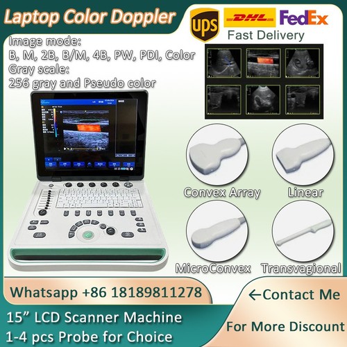 Macchina scanner ultrasuoni