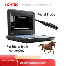 Contec Portable Ultrasound