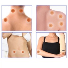 Magnetica Terapia Orecchio 10