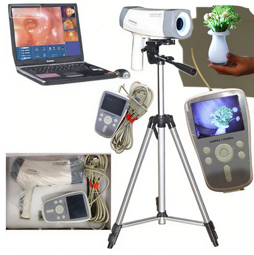 Videocolposcopio fotocamera - videocolposcopio,
