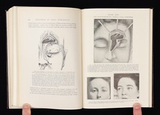 Antique Medical Book