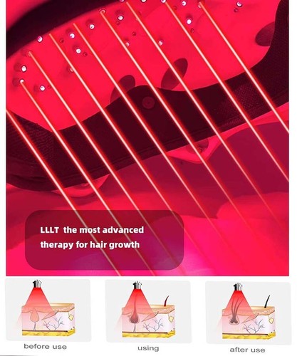 Best infared laser - infared, casco