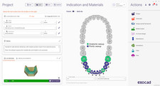 Software cad cam dentali - software, cad/cam