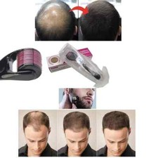 2,5 mm Derma Roller 540 aghi