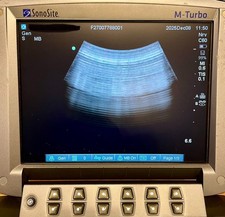 Sonosite C60x buona immagine