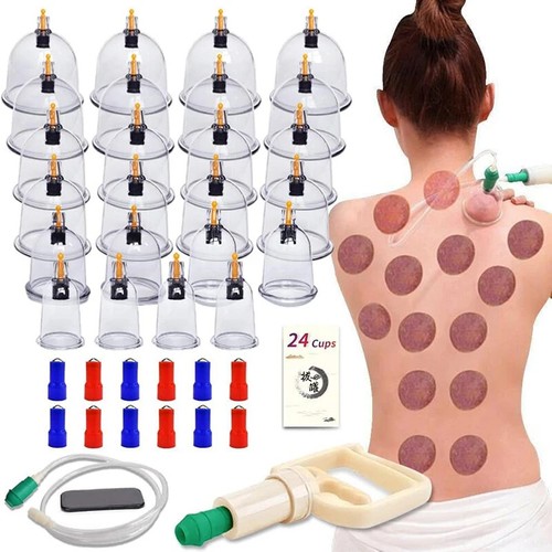 Set terapia coppettazione set