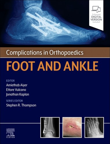 Complications orthopaedics - complications, in