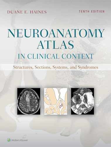 Neuroanatomy atlas clinical - neuroanatomy,