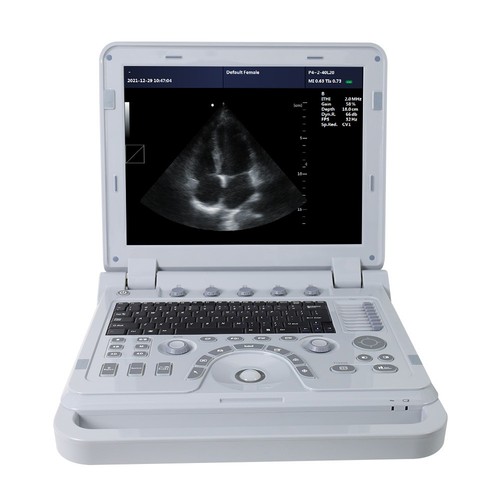 Macchina portatile scanner - portatile,