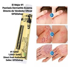 Crema Para Dermatite Eczema Psoriasi Para Comezon Picazon Ronchas En La Piel