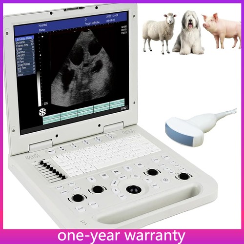 Scanner ultrasuoni portatile - scanner,